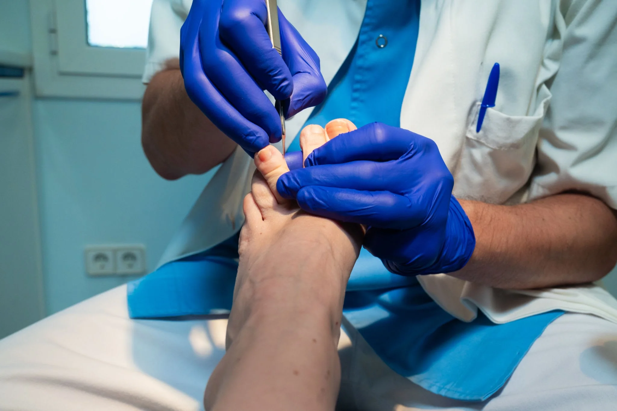 diabetic foot ulcer prevention